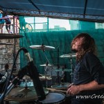 103 Drumming Syndrome